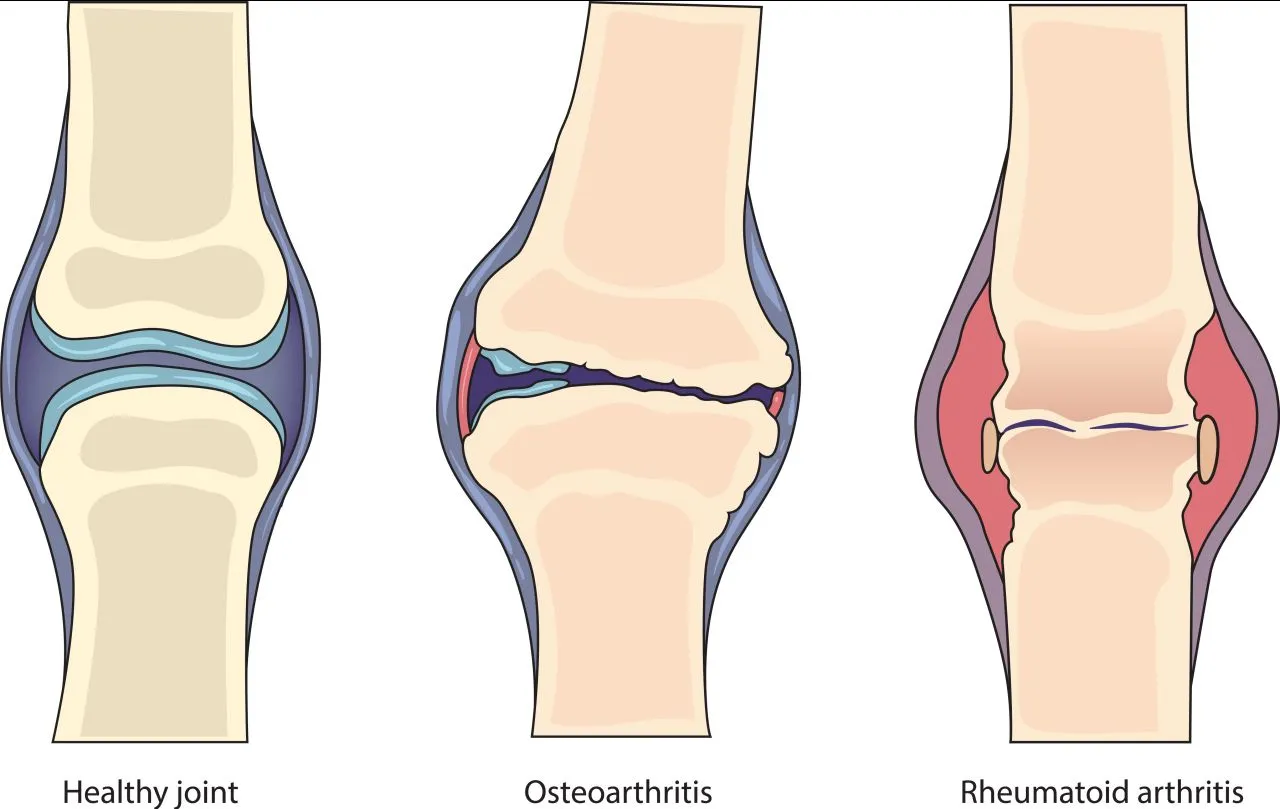 Orthopedic