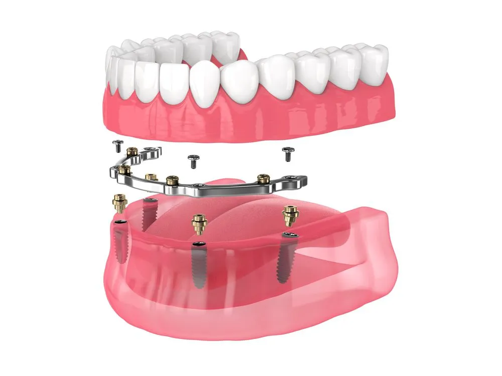 Prosthodontics