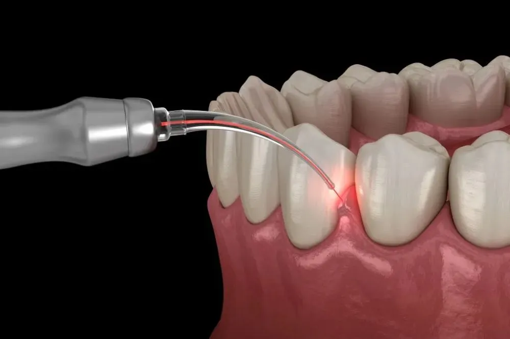 Periodontology