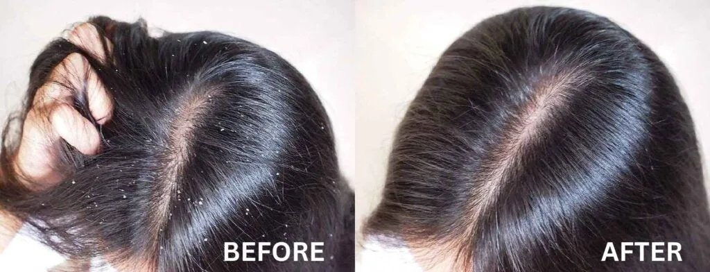 Hair Treatments